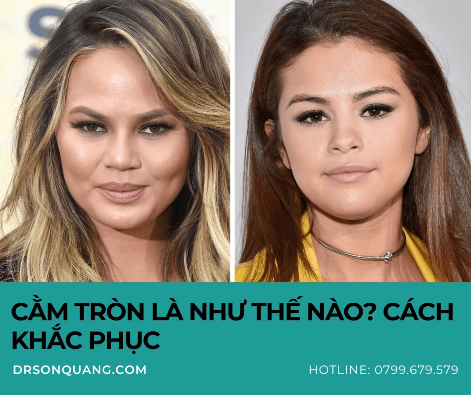 Cằm tròn sau khi phẫu thuật