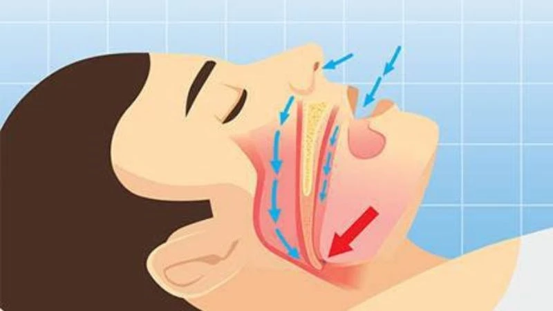 10 dấu hiệu giảm cân thành công bạn không nên bỏ qua