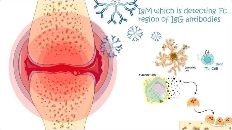 10 dấu hiệu giảm cân thành công bạn không nên bỏ qua